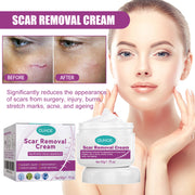 Fade Scars Skin Care Moisturizing Smooth Skin Facial Neck Cream